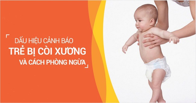 Dấu hiệu trẻ bị còi xương