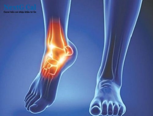 Bệnh viêm khớp cổ chân là gì