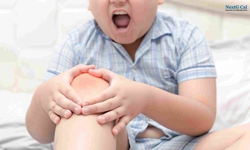 Viêm khớp nhiễm trùng ở trẻ em