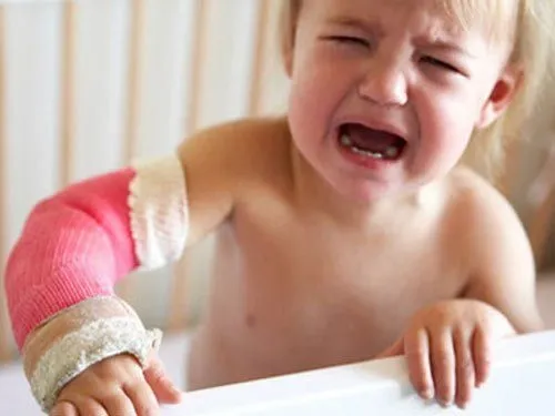 gãy cành tươi là gì