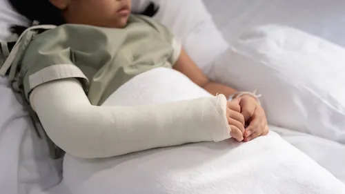 gãy xương kiểu cành tươi