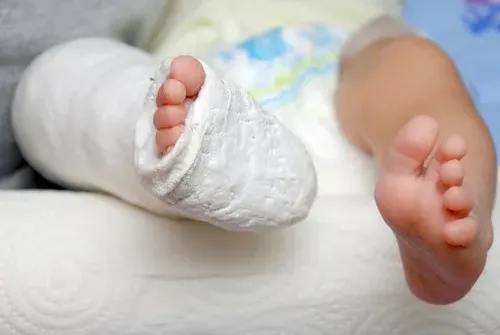 gãy cành tươi đầu dưới xương quay