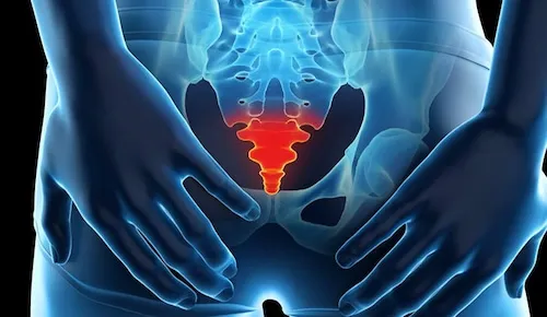 tình trạng gãy xương cụt