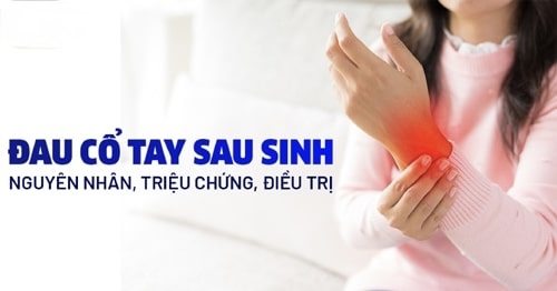 đau cổ tay sau sinh