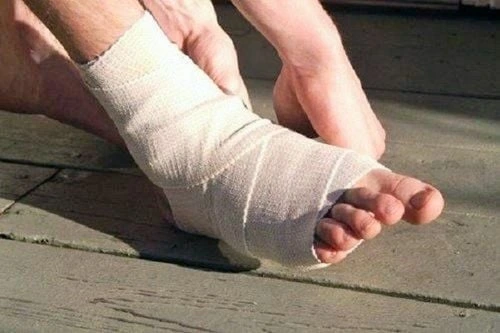 gãy xương có thể vận động ngoài trời hay không