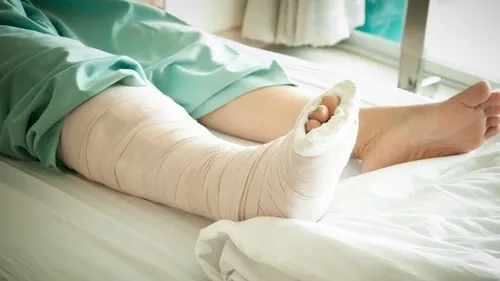 bị gãy xương có đi tắm được không