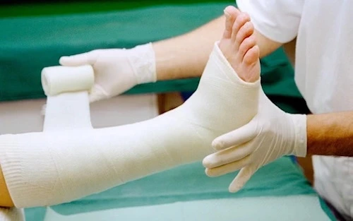 bó bột hay phẫu thuật sẽ tốt cho người gãy xương