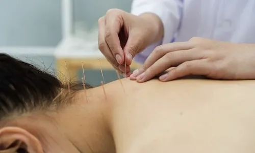 cách trị đau cổ khi ngủ dậy